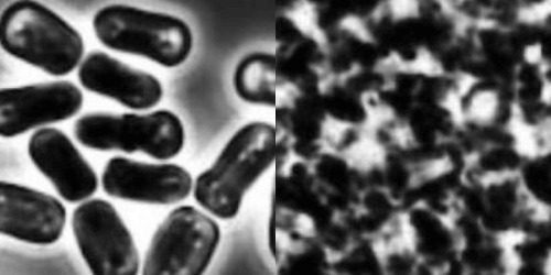 Cell rupture yeast cells before and after homogenization